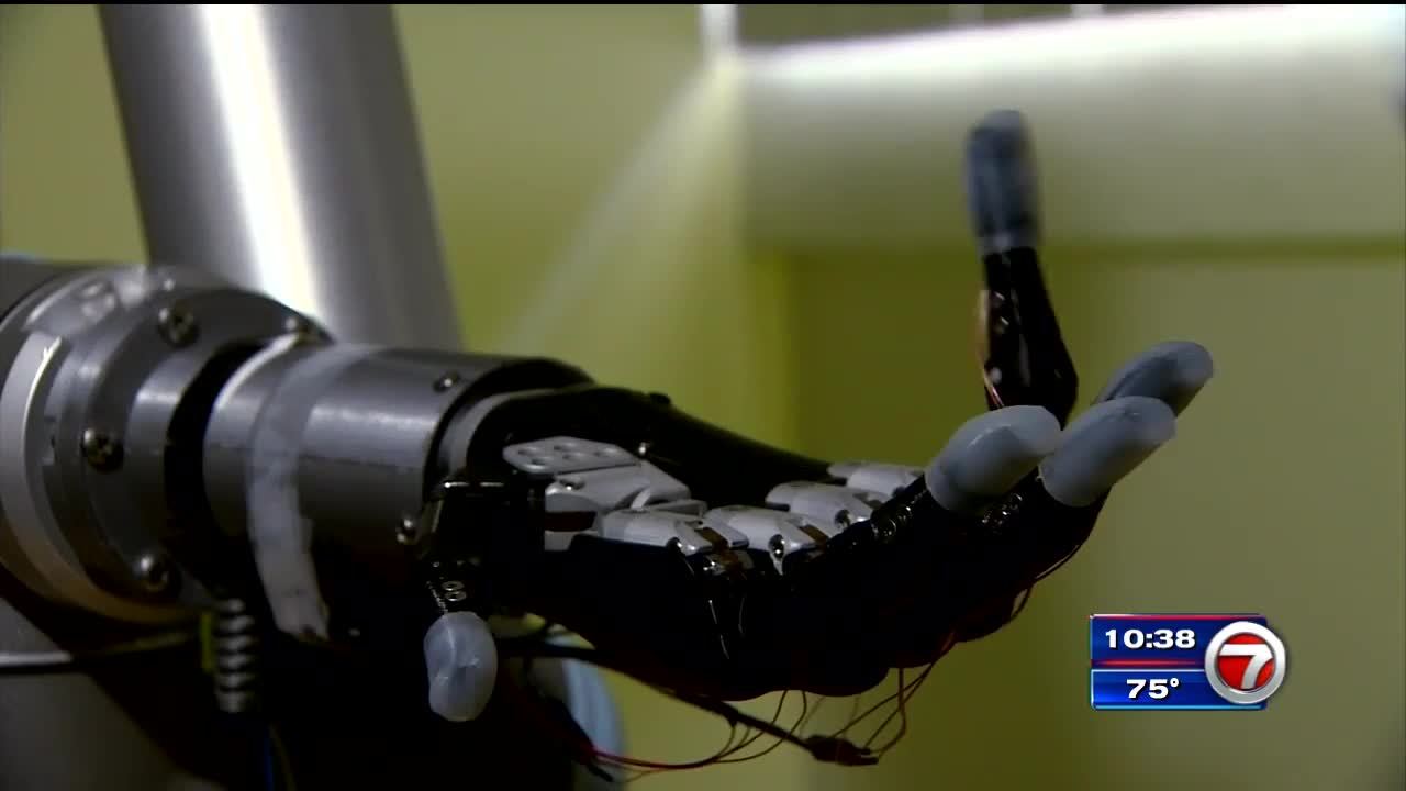 Prosthetic Hand Allows Amputees To Feel Sensations